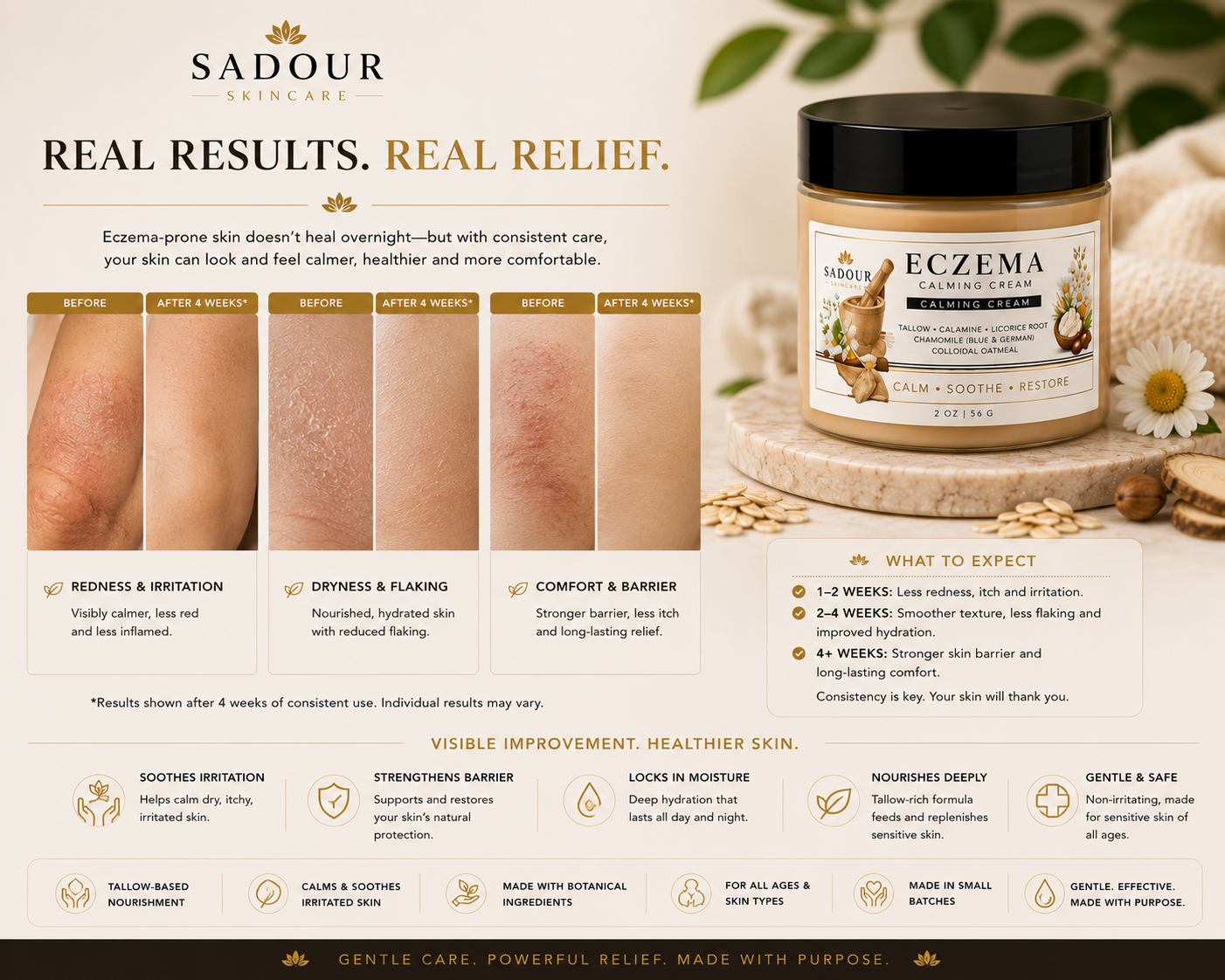 Eczema Calming Cream