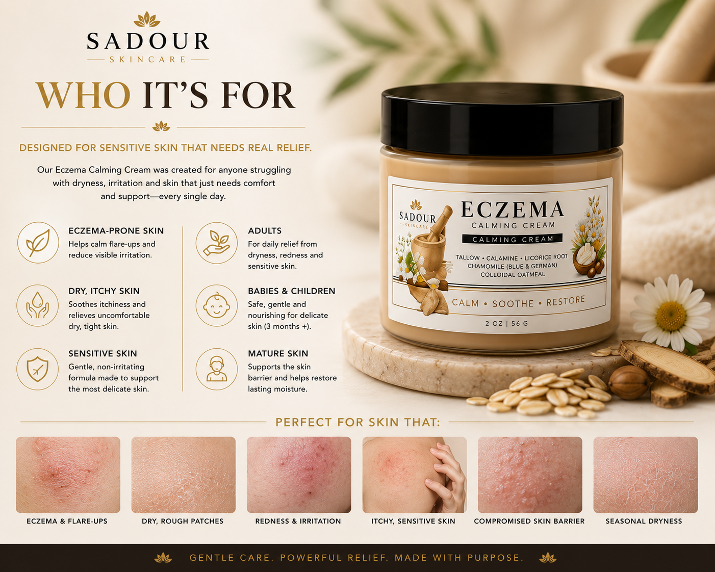 Eczema Calming Cream