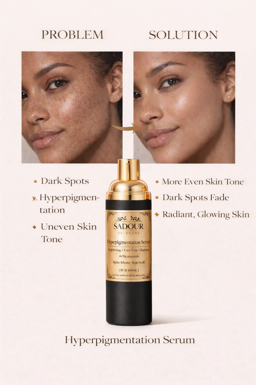 Hyperpigmentation &amp; Age Spot Corrective Serum